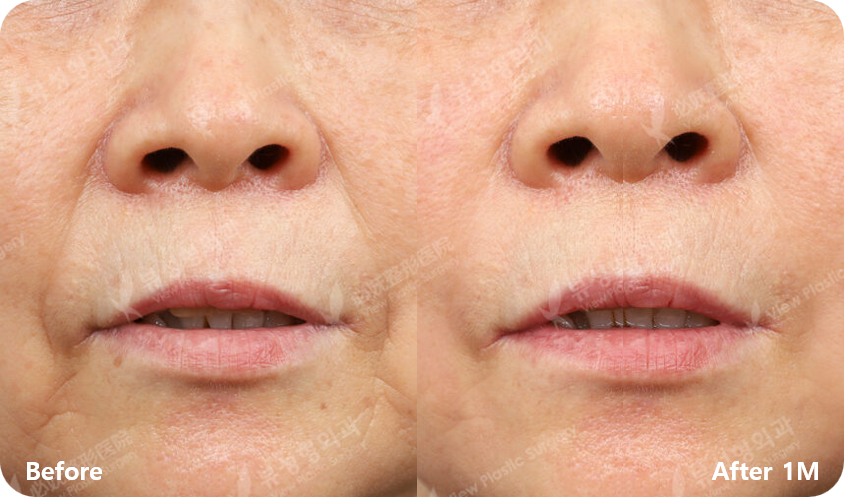 view-skin-clinic-before-after-01