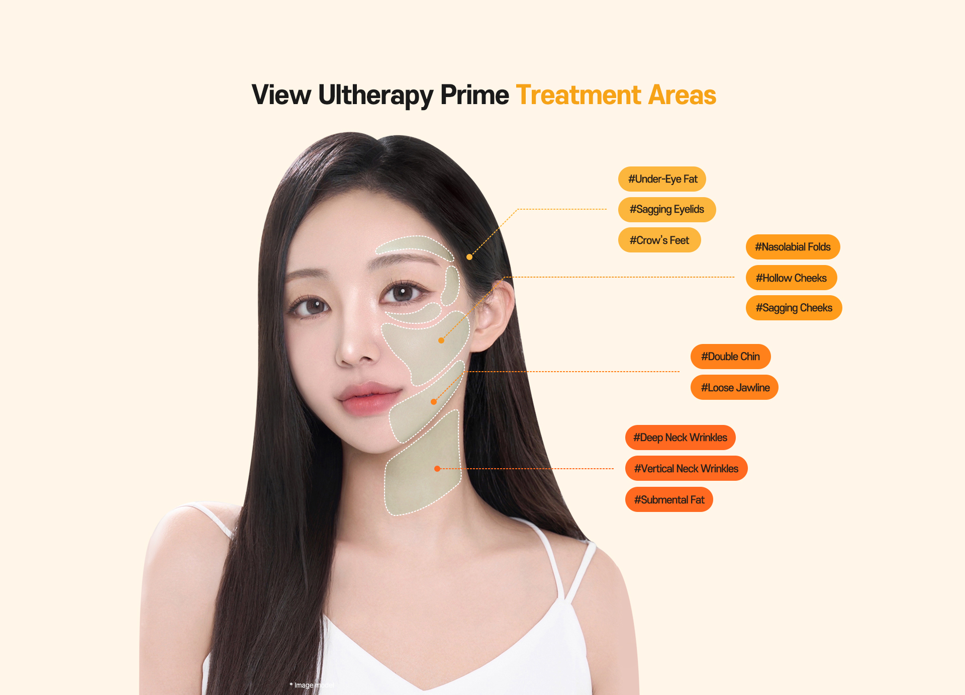 250326_usahome_ulthera_pc-CASE-1